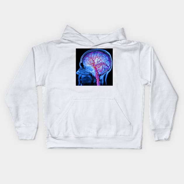 Vascular system of the brain, artwork (C024/6525) Kids Hoodie by SciencePhoto